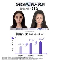 巴黎欧莱雅 欧莱雅玻尿酸水光洗发水440ml控油蓬松柔顺护发去屑清爽