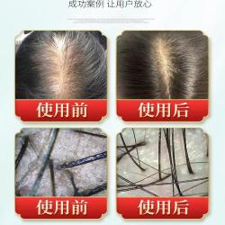 鸿然堂 侧柏叶洗发皂何首乌无患子天然洗头皂中植物草药本手工皂正品