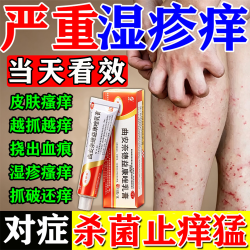 拜都帮 [拜都帮]曲安奈德益康唑乳膏 止痒药膏皮肤瘙痒皮炎湿疹真菌感染止痒药膏皮肤瘙痒皮炎湿疹干燥皮肤用药 15g
