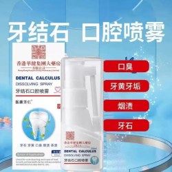 呦越 牙结石溶解剂洗牙齿污垢除口臭去黄美白洁离剂漱口水清洁神器喷雾