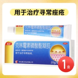 轰克 克林霉素磷酸酯凝胶 20g