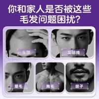 天猫 惯爱米诺地尔搽剂防脱发生发增发育发治疗斑秃米诺地尔官方旗舰店