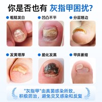 天猫 洛芙盐酸阿莫罗芬搽剂正品灰指甲专用药抗真菌喷雾阿罗莫芬搽剂