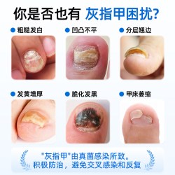 天猫 洛芙盐酸阿莫罗芬搽剂正品灰指甲专用药抗真菌喷雾阿罗莫芬搽剂