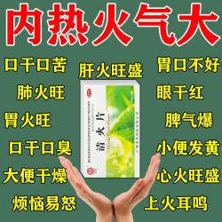 双泉 清火片去火药肿痛咽喉生疮通便目赤眩晕便秘清热泻火肿牙痛AZ