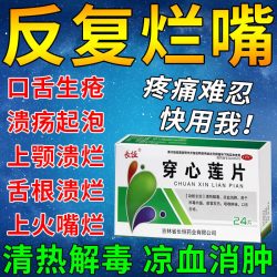 长恒 口腔溃疡专用药口舌生疮药嘴巴上火起泡舌头溃疡口疮中药穿心莲片