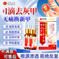 高野小林灰指甲油特殊专指甲真菌感染脱甲增厚有效变亮甲用药膏抑菌液30ml
