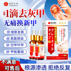 高野小林灰指甲油特殊专指甲真菌感染脱甲增厚有效变亮甲用药膏抑菌液30ml