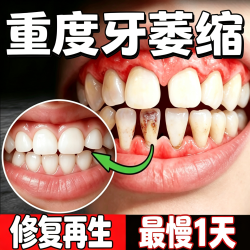 UAOE德国牙龈萎縮专用牙膏护龈固齿修复再生牙周根外露牙齿松炎动正品 1支