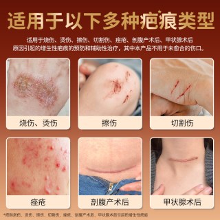 芭愈 沙漠极境医用依克多因硅凝胶预防辅助治疗剖腹产术后疤痕膏
