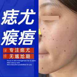 尤/寻常汗管/脖子腋下/颈部/肉揪