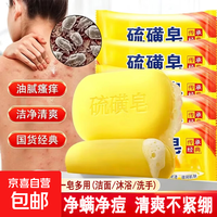 经典硫磺皂后背瘙痒痘控油洗脸香皂男女士沐浴洗澡肥皂净螨 1块