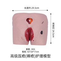 医学训练阶段褥疮护理模型养老护理教学模型四个不同阶段褥疮护理训练模型压疮护理训练模具模拟人医学教学