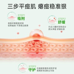 VT° VT老虎痘痘贴净痘舒缓透气不闷隔离污染可上妆服贴韩国66枚*2