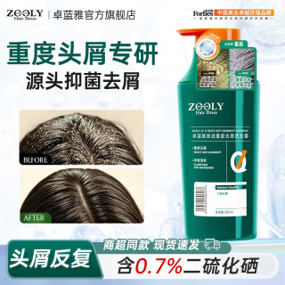 卓蓝雅 二硫化硒去屑洗发水 清洁头皮净澈婍迹清爽控油去屑止痒洗发水 重度去屑洗发水380ml