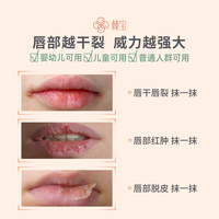 棘宝 沙棘膏滋润唇膏保湿补水宝宝婴儿童学生秋冬护唇膏男女木瓜膏