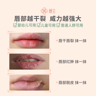 棘宝 沙棘膏滋润唇膏保湿补水宝宝婴儿童学生秋冬护唇膏男女木瓜膏