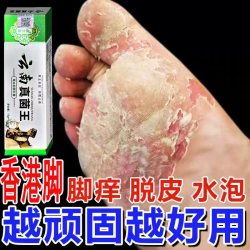 云南真菌王脚痒脚臭止痒膏脚后跟起皮粗糙干裂止痒抑菌
