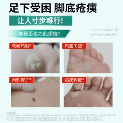 黄氏好舒鸡眼软膏深层脱落增生肉刺改善厚硬鸡眼 舒缓刺痛不适