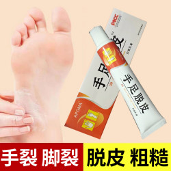 手足脱皮润肤霜护肤膏手足干燥皲裂缓解脱皮草本手足护理保湿外用