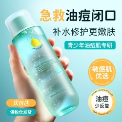 MASATA 青少年护肤品控油祛痘爽肤水补水保湿收缩毛孔去闭口粉刺湿敷水