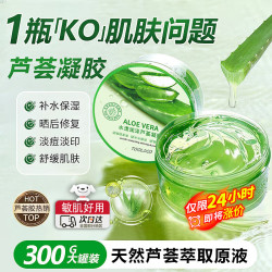英滴 天然芦荟胶补水保湿滋润嫩肤消皮肤炎男女士可用300g教师节礼物