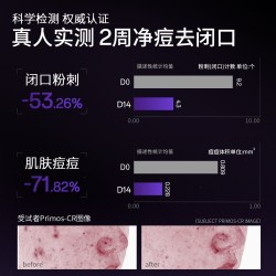 BR:LAB 杏仁酸精华30ml水杨酸刷酸温和祛痘印去闭口粉刺疏通毛孔去