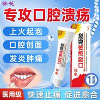葵花药业 葵花 医用口腔溃疡凝胶口腔水泡溃烂红肿嘴角炎嘴巴起泡口腔护理