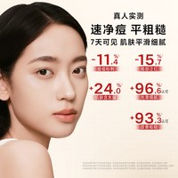 达尔肤 杏仁酸祛痘身体喷雾胸前后背部净痘果酸